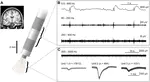 Interictal spikes with and without high-frequency oscillation have different single-neuron correlates